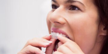 Does Invisalign Work? Pros, Cons, Effectiveness