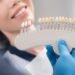 How to Choose the Best Cosmetic Dentist